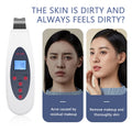 LUMASKINTECH Skin Scrubber — Deep Pore Purifier & Radiance Reviver